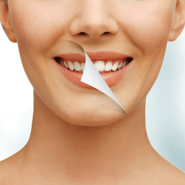 Smile Design & Dentisterie